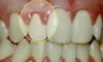 Periodontal Dentistry